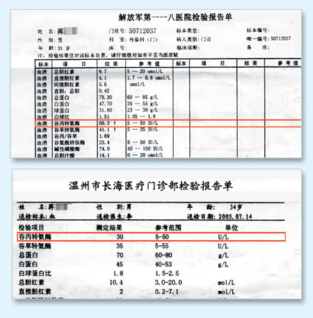 化验单