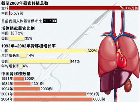 解读卫生部严限为外国人实施器官移植背后