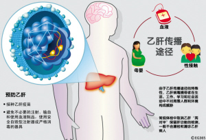 看懂指标防治乙肝