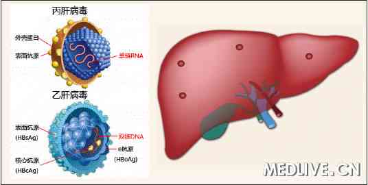 2011重大中国研究——肝病 乙肝 丙肝 病毒性肝炎 肝硬化 非酒精性脂肪肝 