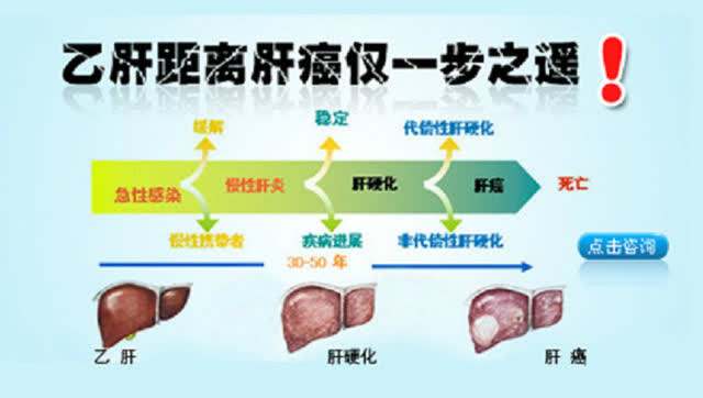 怎样防止乙肝癌变？