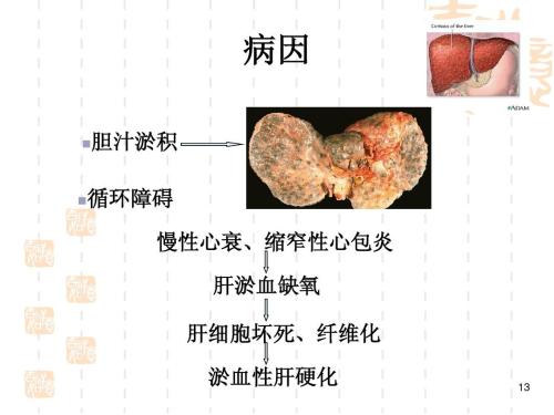 乙肝患者怎样才能长寿？