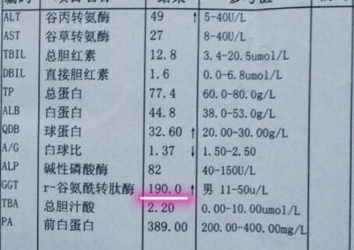 谷氨酰转肽酶偏高会是肝癌吗？