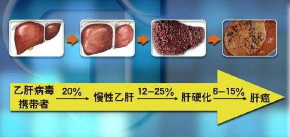 什么是非活动性乙肝病毒携带者?