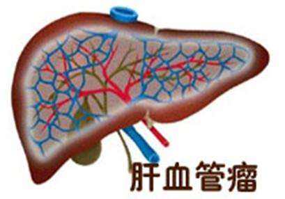 肝脏上长肿瘤是癌症吗？