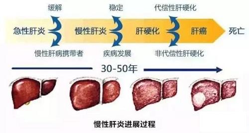 慢性乙型病毒性肝炎、病毒性肝炎指南