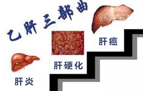 乙肝方面的知识