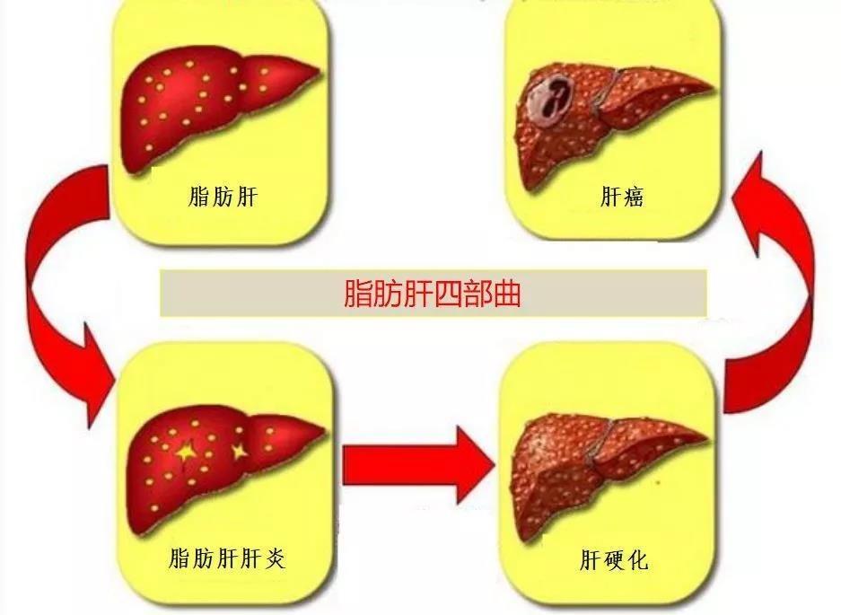 谷氨酰转肽酶升高的原因有哪些?